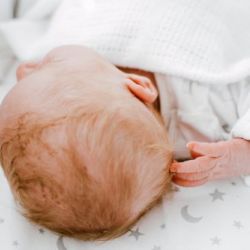 Plagiocefalia en bebés