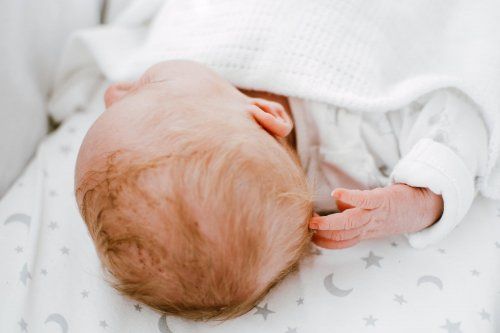 Plagiocefalia en bebés